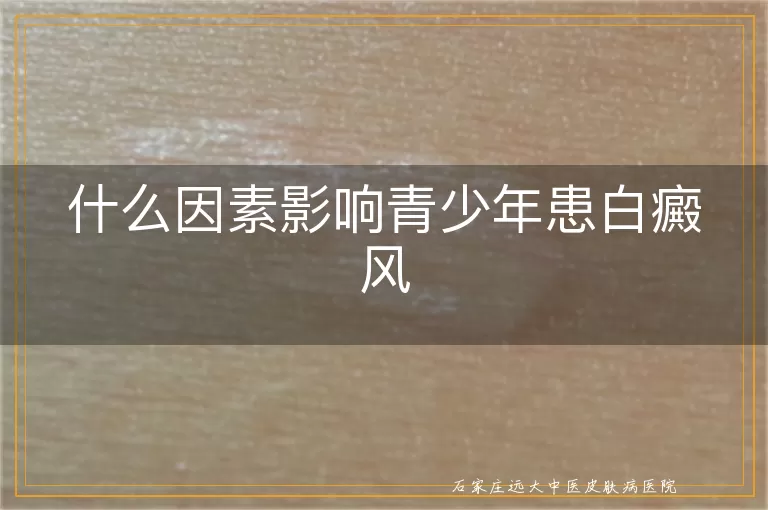 什么因素影响青少年患白癜风