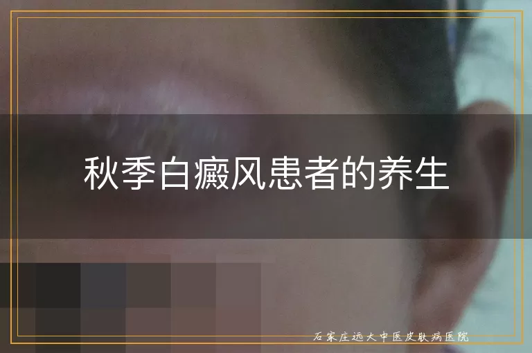 秋季白癜风患者的养生
