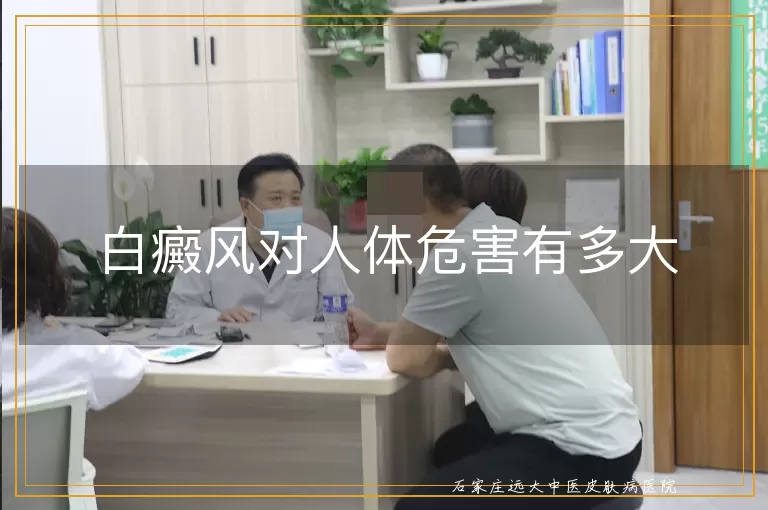 白癜风对人体危害有多大