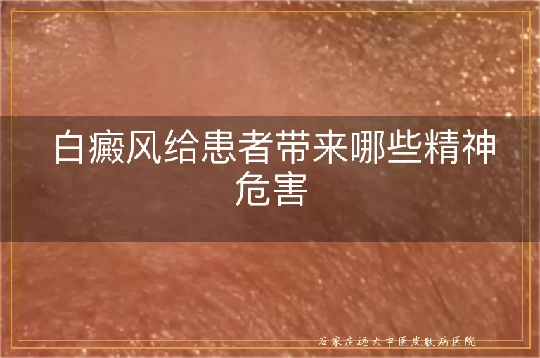 白癜风给患者带来哪些精神危害