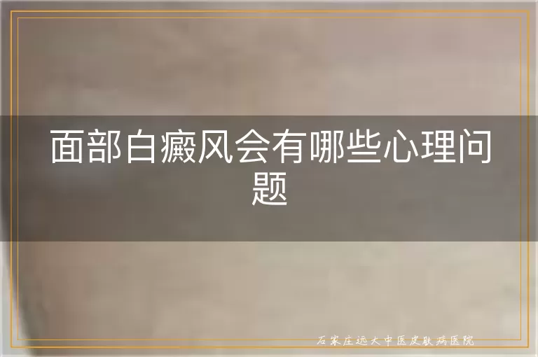 面部白癜风会有哪些心理问题