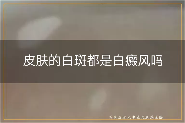 皮肤的白斑都是白癜风吗