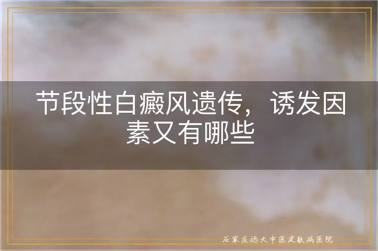 节段性白癜风遗传，诱发因素又有哪些