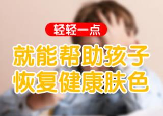 15岁男孩腿部长白斑专科医院治疗好不好，收费贵吗