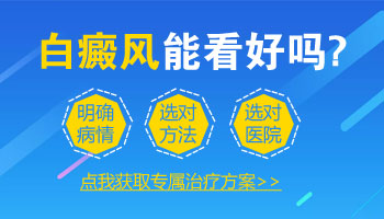 15岁男孩额头有白癜风逐渐变大该怎么办，如何治疗