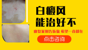 15岁男孩腰部有白斑逐渐变大该怎么办，如何治疗