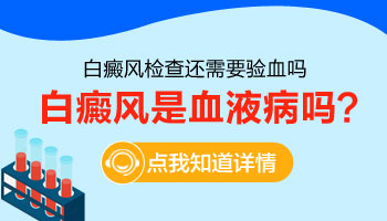 青少年手上长白癜风用308激光治好后复发几率多大