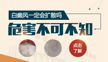 15岁男孩背部有圆形白斑怎么治疗比较好，用中药可以吗