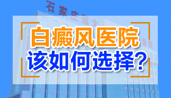 青少年腰部长白癜风不吃药能治疗好吗，用什么仪器