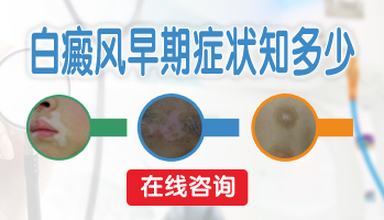 15岁男孩腰部长圆形白斑怎么治疗比较好，用中药可以吗