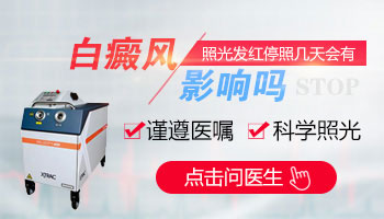 青少年腰部有白点该怎么治疗，有康复案例吗