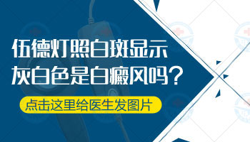青少年腰部有白点该怎么治疗，有康复案例吗