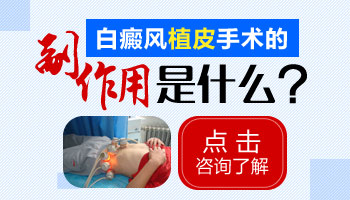 15岁男孩腰部有白斑到哪家医院能治疗好，哪家医院专业