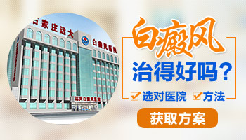 青少年脸部有白癜风照uvb治好后复发几率多大