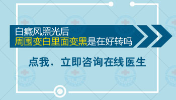 15岁男孩脸部长白点照UVB能治得好吗，要配合什么药物