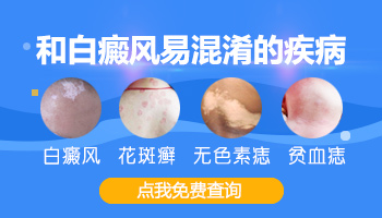 青少年额头有圆形白斑逐渐变大该怎么办，如何治疗