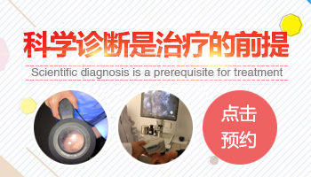 15岁男孩腰部有白癜风不吃药能治疗好吗，用什么仪器