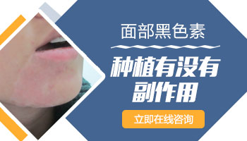 15岁男孩腰部有白癜风照UVB能治得好吗，要配合什么药物