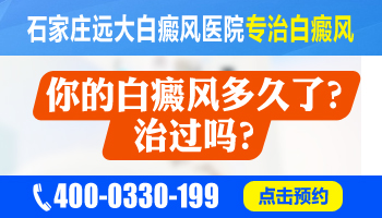 青少年脸部长白斑怎么治疗比较好，用中药可以吗