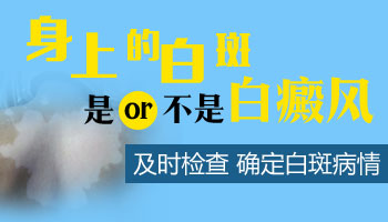 青少年腰部有白块专科医院治疗好不好，收费贵吗