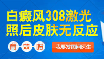 青少年额头有白斑专科医院治疗好不好，收费贵吗