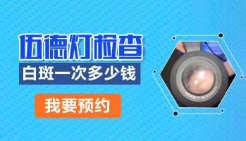 青少年肩膀长白斑该怎么治疗，有康复案例吗