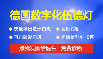 青少年背部长圆形白斑怎么治疗，哪种方法好