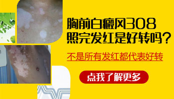 15岁男孩手臂长白癜风怎么治疗比较好，用中药可以吗