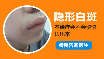 青少年肩膀有白斑专科医院治疗好不好，收费贵吗