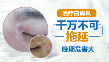青少年额头长白点如何治疗，哪种方法好