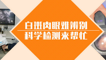 15岁男孩脸部有白点哪种偏方治疗效果最好