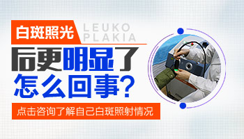 15岁男孩额头长白块治疗好后用什么方法巩固不再复发