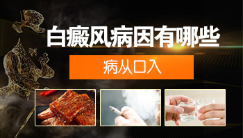 青少年背部长白癜风怎么治疗比较好，用中药可以吗