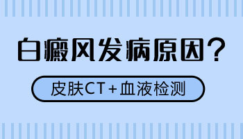 15岁男孩腿部有白斑照308激光康复率真的高吗，如何治疗的