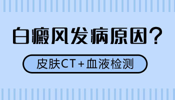 青少年手上有圆形白斑用什么方法治疗好的快