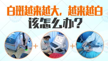 15岁男孩腰部长白斑用308激光治好后复发几率多大