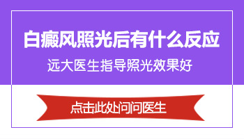 青少年腰部长圆形白斑激光治疗怎么样，多久能康复